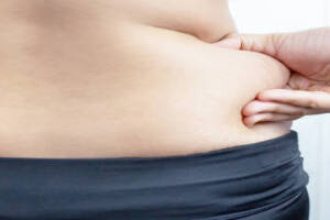 Liposuction in Riyadh